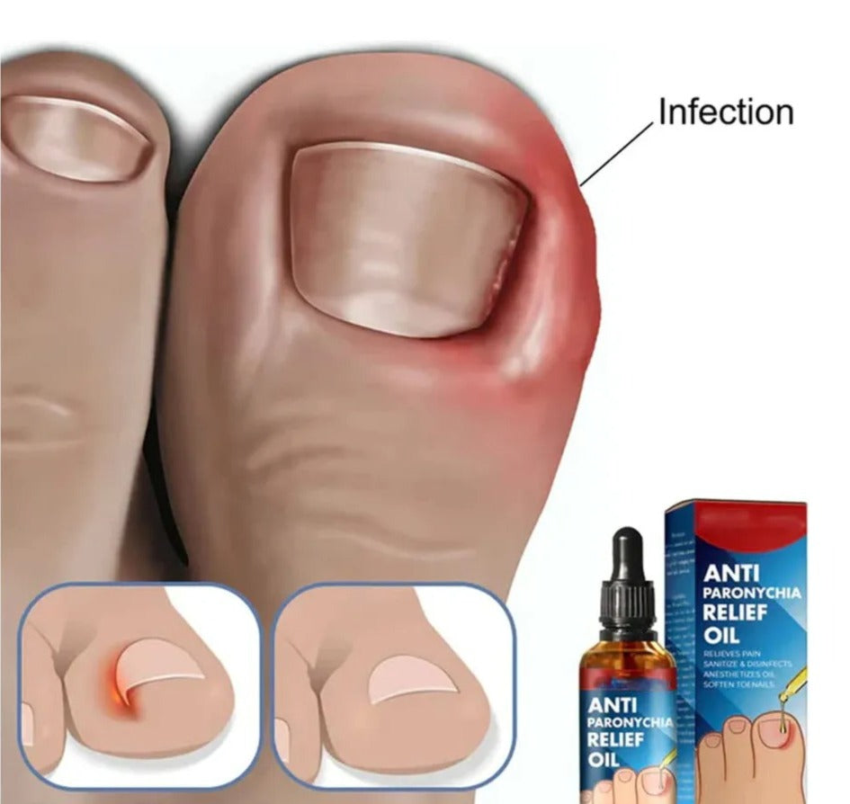 ✨ Tratamiento antifúngico y para uñas encarnadas – ToenailPlus 💅🌿💥