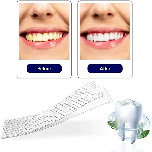 Tu sonrisa perfecta en segundos — sin dolor, sin dentista, sin gastar una fortuna